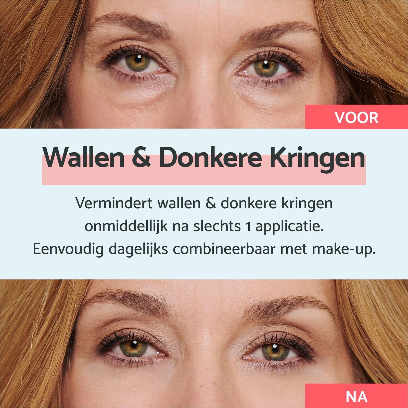 Eye Bags & Dark Circles - Image 6