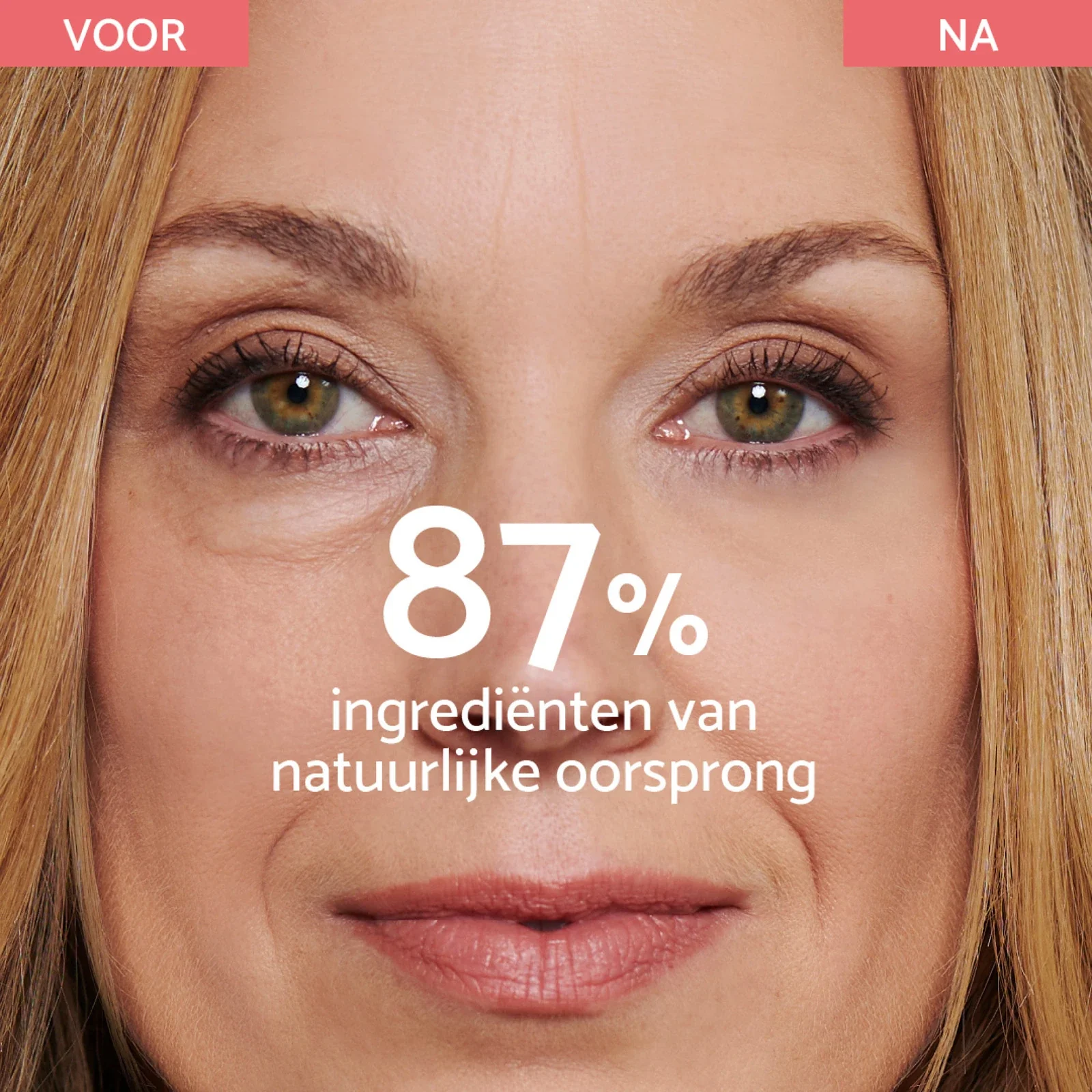 Eye Bags & Dark Circles - Image 7