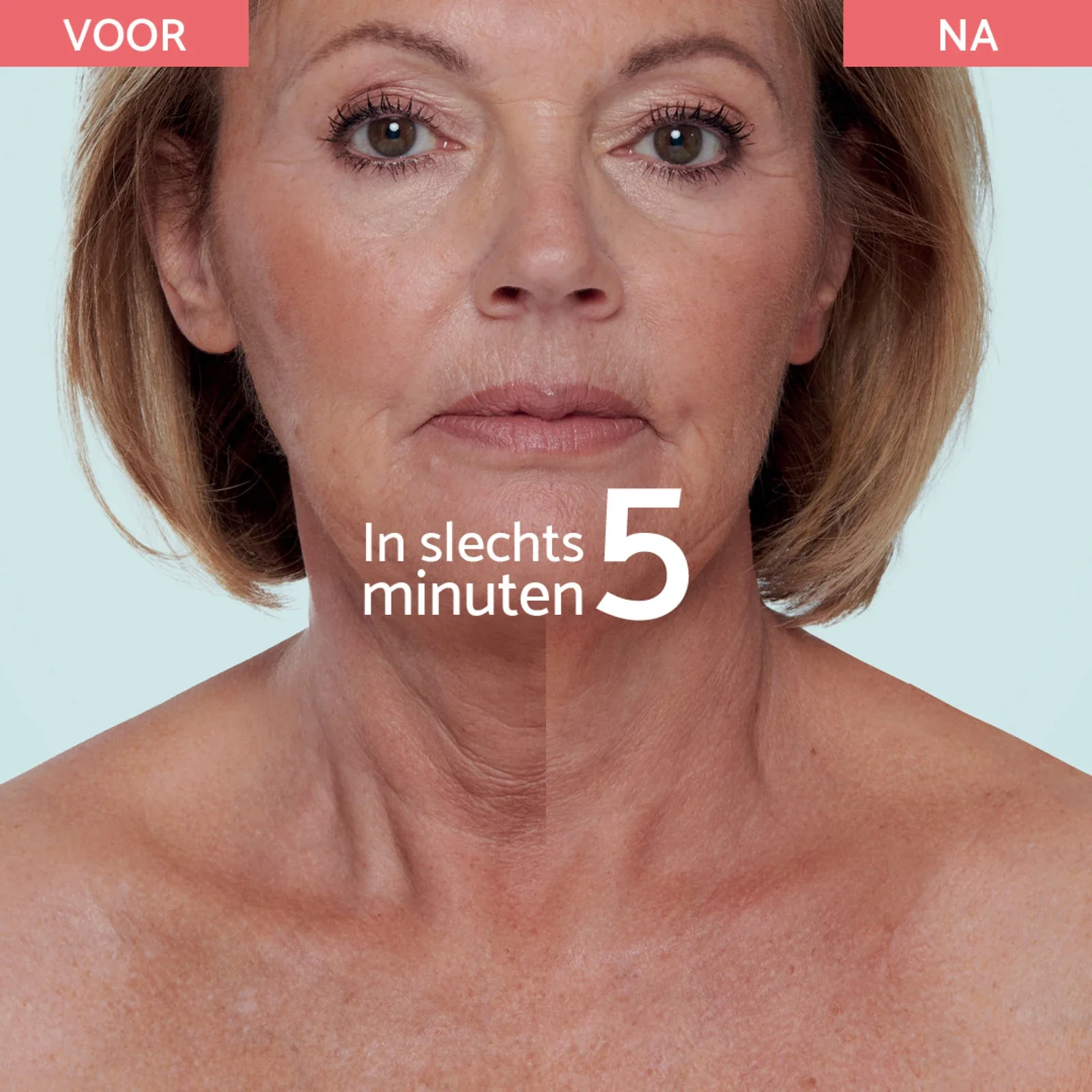 Neck & Décolleté - Instant Lifting - Image 5